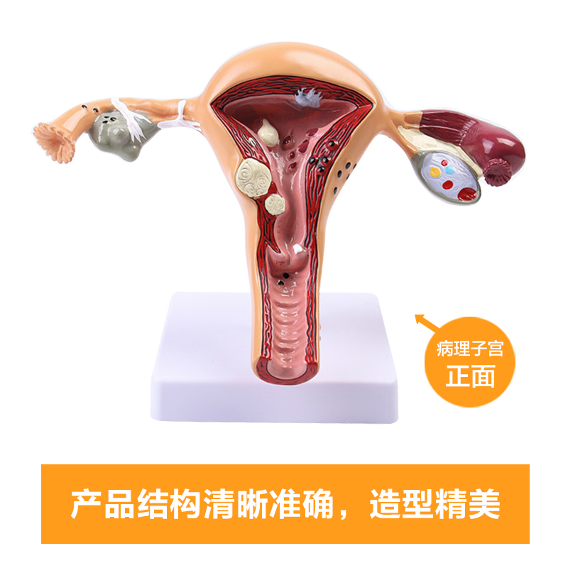 女性子宫模型 卵巢模型 女性阴道 女性内生殖器解剖模型 妇科培训