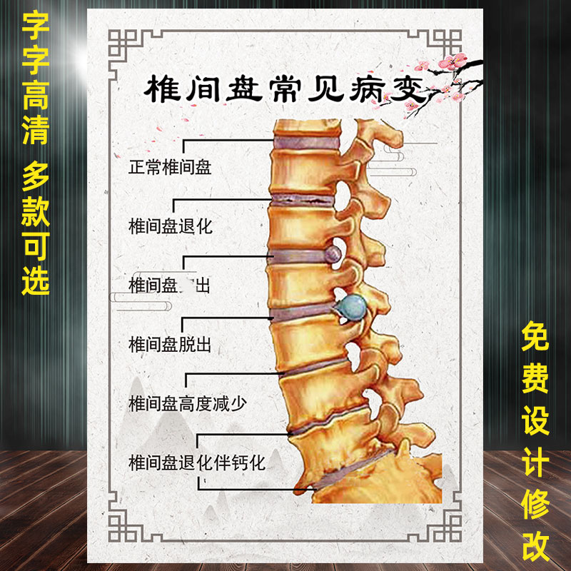 椎间盘常见病变海报腰椎间盘突出颈椎肩颈保养图中医养生馆宣传画