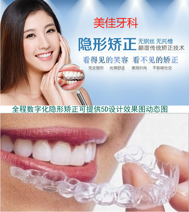 定制隐形牙齿矫正器夜防磨牙套美白牙托保持器牙缝大龅牙整牙神器