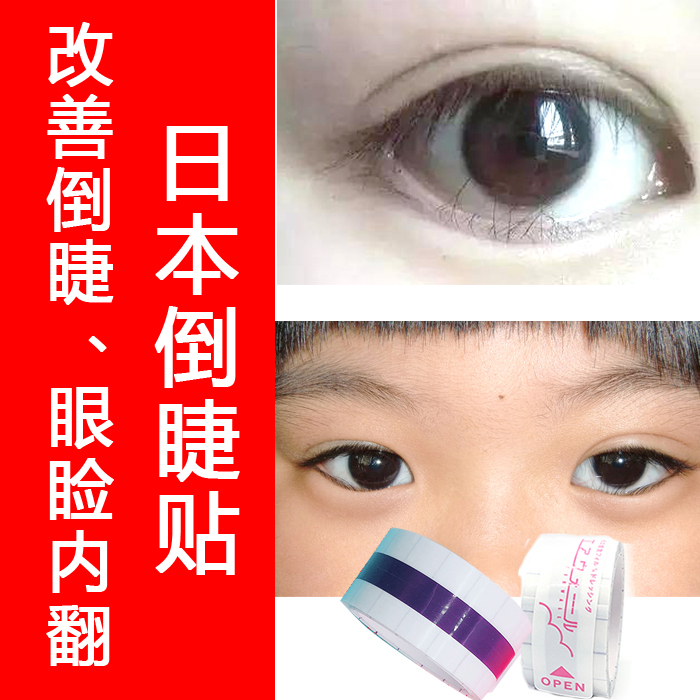 日本倒睫贴儿童下眼睑倒睫毛胶带眼贴 内睑外翻娇正 改善倒睫胶布