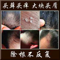 去氧化神器-清洁剂小白鞋边鞋底氧化发黄去除